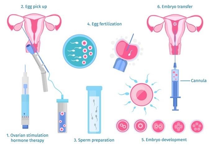 چگونه IVF یا لقاح مصنوعی موفقی داشته باشیم
