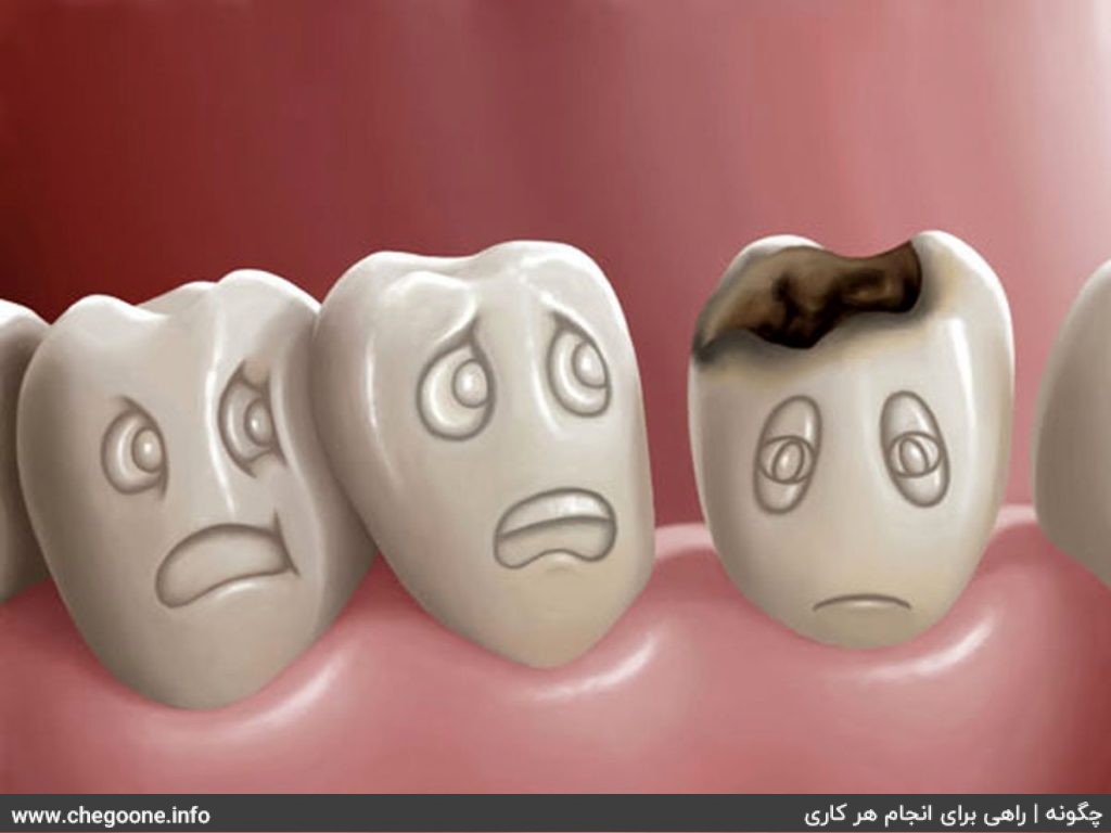 چگونه از پوسیدگی دندان جلوگیری کنیم