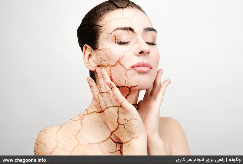 چگونه ترک های پوستی را از بین ببریم چگونه ترک های پوستی را از بین ببریم