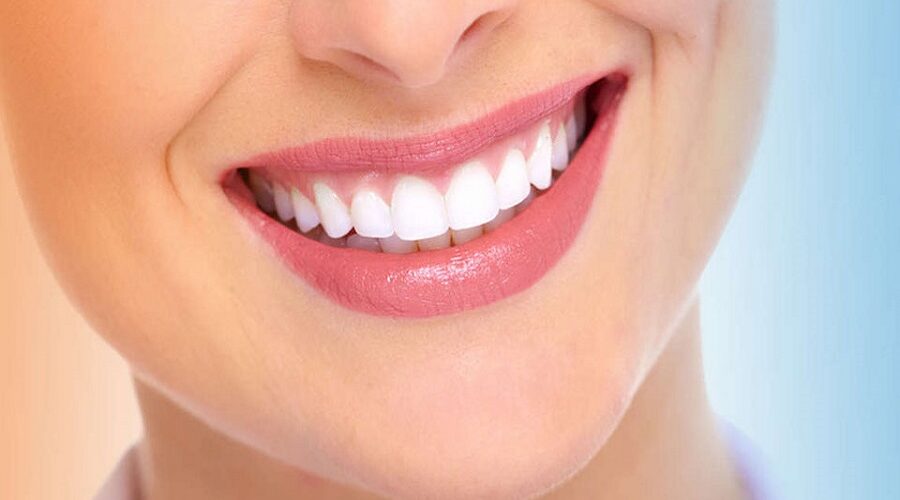 چگونه دندان سفیدی داشته باشیم