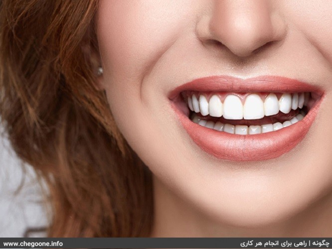 چگونه دندان سفیدی داشته باشیم چگونه دندان سفیدی داشته باشیم