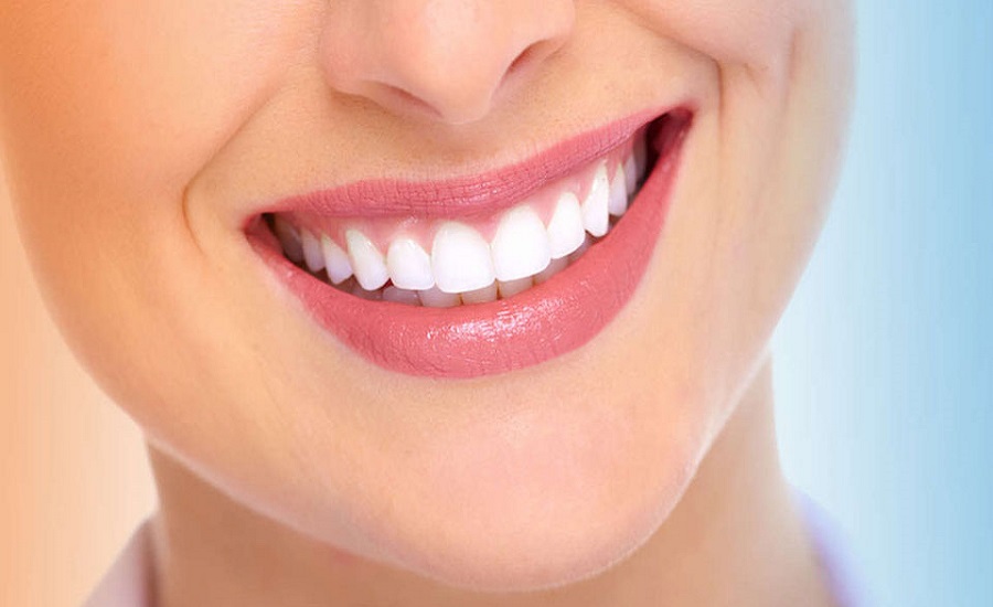 بهترین روش های سفید کردن دندان در خانه و دندانپزشکی