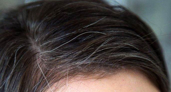 رفع سفیدی مو و روش هایی برای پیشگیری و درمان