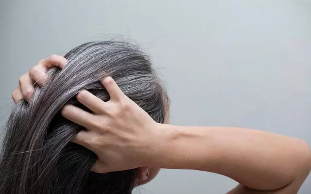 رفع سفیدی مو و روش هایی برای پیشگیری و درمان